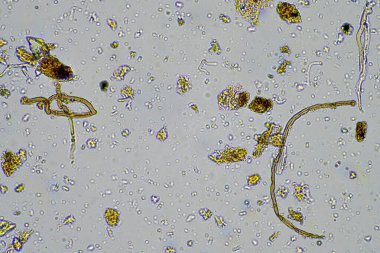 Bir çiftlikte mikroskop altında toprak numunesinde yaşayan yaşam.