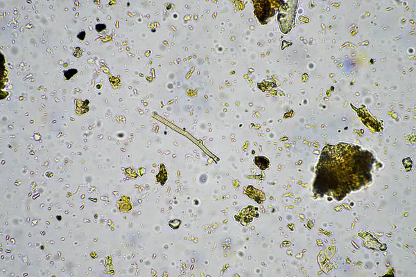 Żywotność Gleby Próbce Gleby Pod Mikroskopem Gospodarstwie — Zdjęcie stockowe