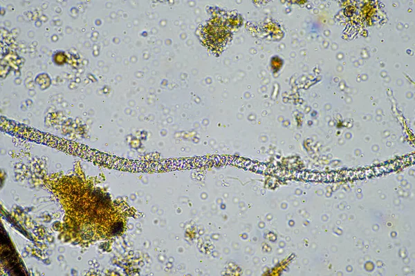 Élő Talajélet Mikroszkóp Alatti Talajmintában Egy Gazdaságban — Stock Fotó