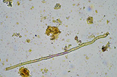 Çiftlikteki toprak örneğinde mantar hyphae. Bir çiftlikteki toprakta karbon depolayan mantarlar