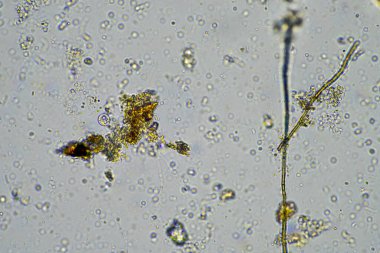 Çiftlikteki toprak örneğinde mantar hyphae. Bir çiftlikteki toprakta karbon depolayan mantarlar