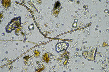 Çiftlikteki toprak örneğinde mantar hyphae. Bir çiftlikteki toprakta karbon depolayan mantarlar