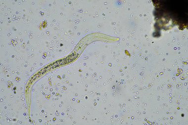 Avusturalya 'da bir çiftlikte mikroskop altında toprak numunesinde bakteriyel beslenme toprağı nematodu. 