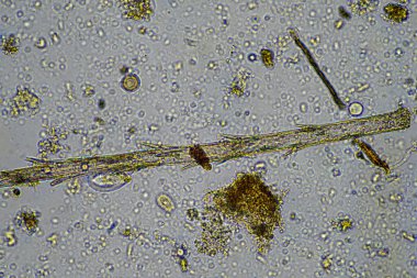 Çiftlikteki toprak örneğinde mantar hyphae. Avustralya 'da toprakta karbon depolayan mantarlar