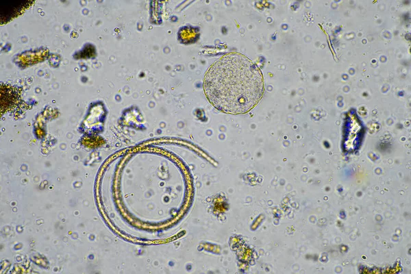实验室显微镜下的土壤样品中的活的土壤生物 — 图库照片