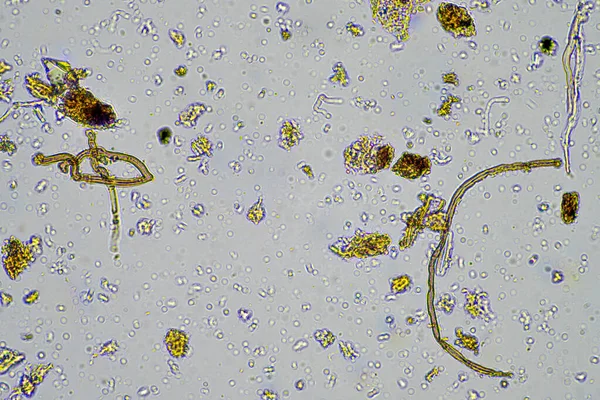农场显微镜下的土壤样品中的活的土壤生物 — 图库照片