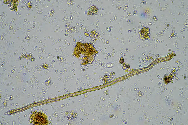 Φυτική Κυτταρίνη Δείγμα Εδάφους Κάτω Από Μικροσκόπιο Εκμετάλλευση — Φωτογραφία Αρχείου