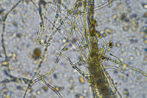 fungal hyphae on a soil sample on a farm. fungi storing carbon in the soil in australia
