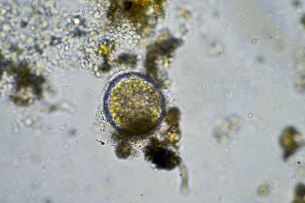 Avustralya 'da bir çiftlikteki toprak numunesinde ciliate sporu