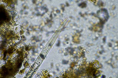 Toprak ve böcekli toprak numunesi olan bir tarım uzmanı. karbon depolayan mikroorganizmalar bir çiftlikten mantar ve bakteri ile