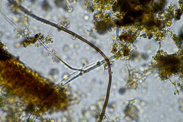 Агроном Образцом Почвы Жизнью Почвы Насекомыми Микроорганизмы Хранящие Углерод Грибками — стоковое фото