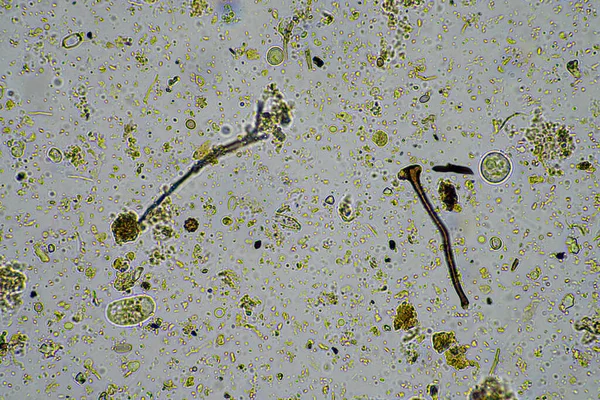 Agronomem Próbką Gleby Życiem Gleby Robakami Mikroorganizmy Składujące Węgiel Grzybami — Zdjęcie stockowe