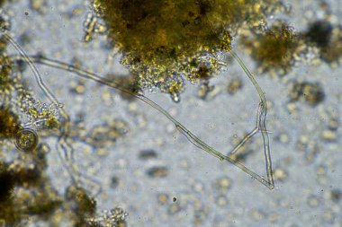 Toprak ve böcekli toprak numunesi olan bir tarım uzmanı. karbon depolayan mikroorganizmalar bir çiftlikten mantar ve bakteri ile