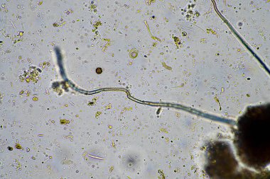 Toprak ve böcekli toprak numunesi olan bir tarım uzmanı. karbon depolayan mikroorganizmalar bir çiftlikten mantar ve bakteri ile