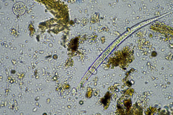 Agrónomo Con Una Muestra Suelo Con Vida Suelo Insectos Microorganismos — Foto de Stock