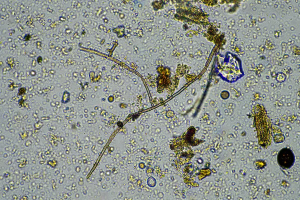 생명과 버그와 샘플을 Agronomist 농장에서 곰팡이와 박테리아로 탄소를 저장하는 미생물 — 스톡 사진