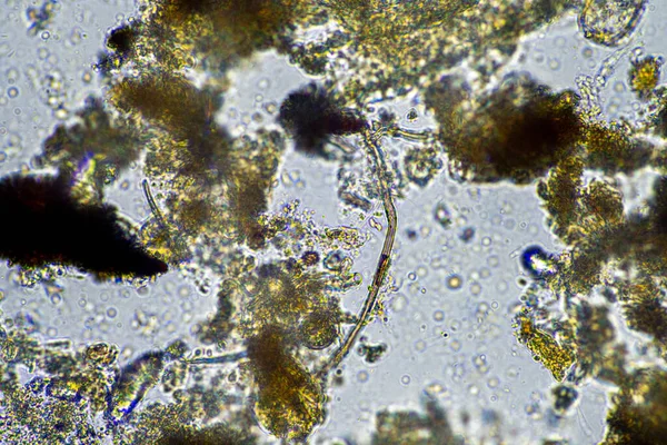 Agronomem Próbką Gleby Życiem Gleby Robakami Mikroorganizmy Składujące Węgiel Grzybami — Zdjęcie stockowe