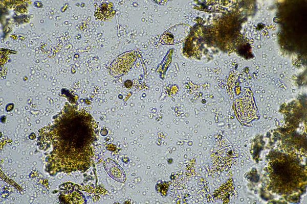 생명과 버그와 샘플을 Agronomist 농장에서 곰팡이와 박테리아로 탄소를 저장하는 미생물 — 스톡 사진
