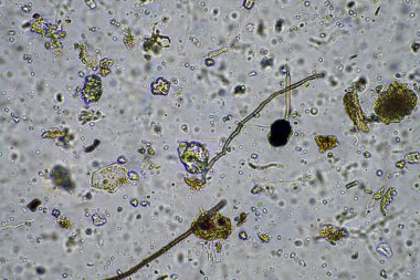 Toprak örneğinde mantar ve toprak mantarları canlı toprağın bir çiftliği oluşturduğunu gösteriyor.