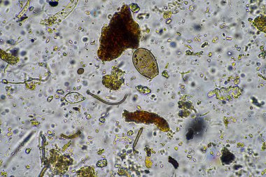 Toprak örneğinde mantar ve toprak mantarları canlı toprağın bir çiftliği oluşturduğunu gösteriyor.