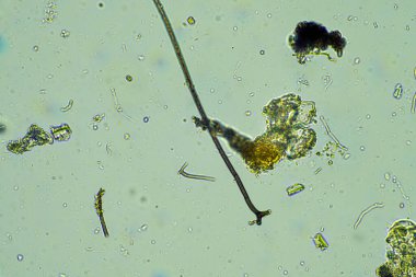 Avustralya 'da bir çiftlikte toprak örneğinde arcella, mantar ve nematode. 