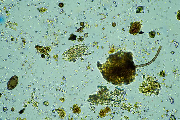 Mikroorganizmalar Mikroskop Altında Bir Örnekte 400X Büyütme — Stok fotoğraf