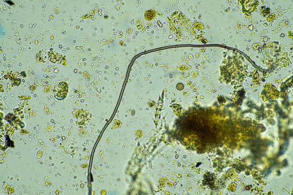Микроорганизмы Микроскопом 400 Кратном Увеличении Образце — стоковое фото