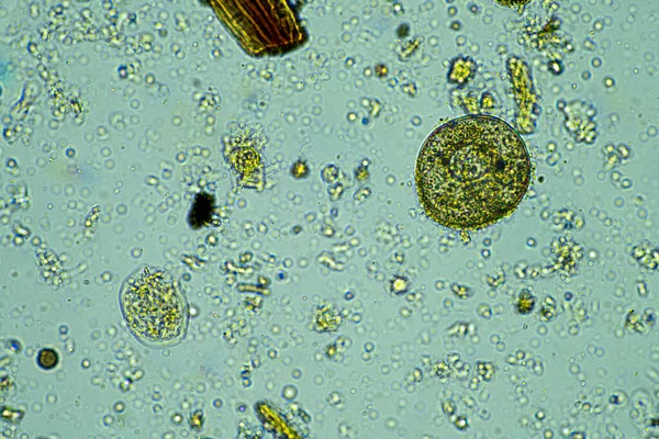 Microrganismi Microscopio Con Ingrandimento 400X Campione — Foto Stock