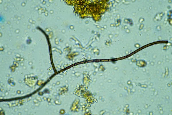 Mikroorganismer Mikroskop Vid 400X Förstoring Ett Prov — Stockfoto