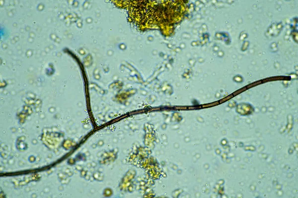 Μικροοργανισμοί Μικροσκόπιο Μεγέθυνση 400X Δείγμα — Φωτογραφία Αρχείου