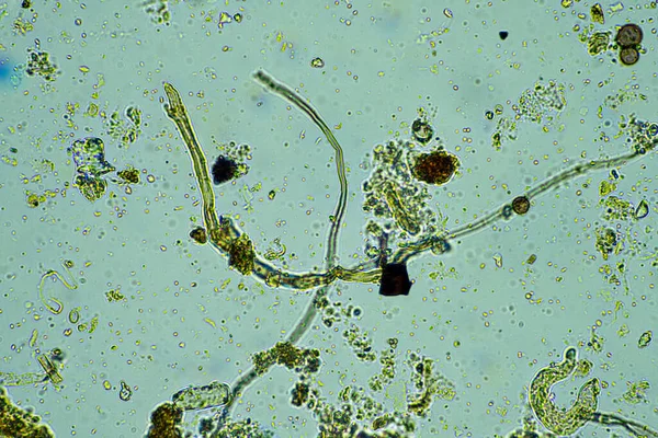 Microrganismos Microscópio Com Aumento 400X Numa Amostra — Fotografia de Stock