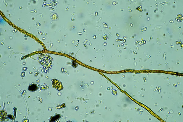 Microorganismos Bajo Microscopio 400X Aumento Una Muestra — Foto de Stock