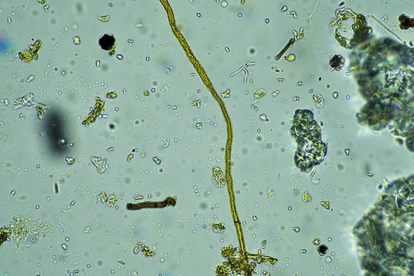 Mikroorganizmy Pod Mikroskopem Przy Powiększeniu 400 Krotnym Próbce — Zdjęcie stockowe