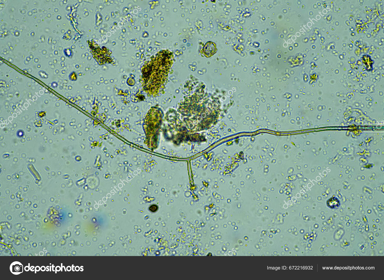 Microorganisms Microscope 400X Magnification Sample Stock Photo by ©wedge  672216932
