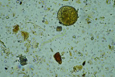 arcella, fungi and nematode in a soil sample on a farm in australia  clipart