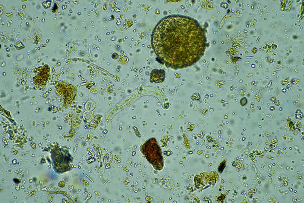 Мікроорганізми Під Мікроскопом Збільшенні 400X Вибірці — стокове фото