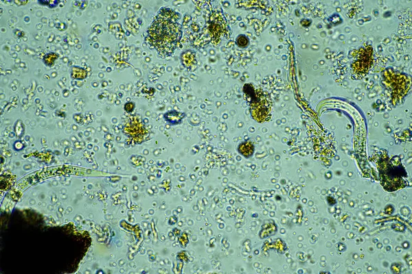 Mikroorganizmalar Mikroskop Altında Bir Örnekte 400X Büyütme — Stok fotoğraf