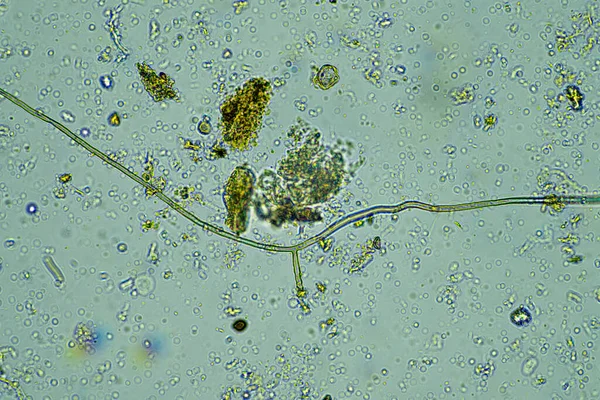 Microorganismos Bajo Microscopio 400X Aumento Una Muestra — Foto de Stock