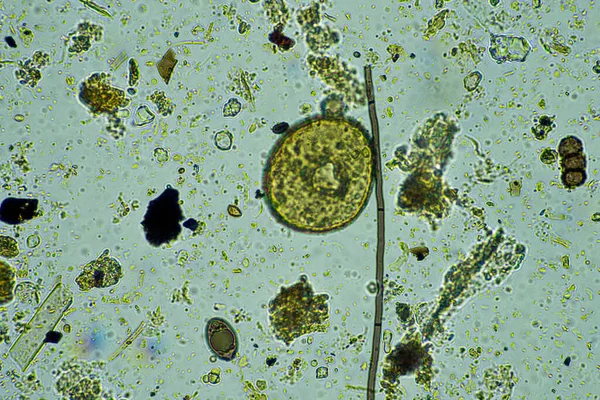 microorganisms under a microscope at 400x magnification in a sample