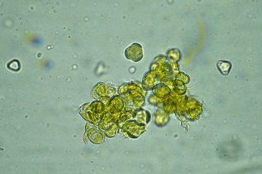  Avustralya balı mikroskop altında 400x