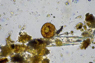 mikrobik organizmalar mikroskop altında Amerika 'da bir laboratuvarda