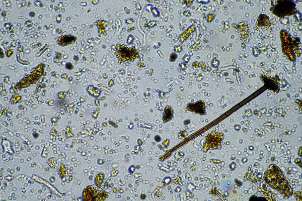 Pilz Und Pilzhyphen Unter Dem Mikroskop Boden Und Auf Dem — Stockfoto