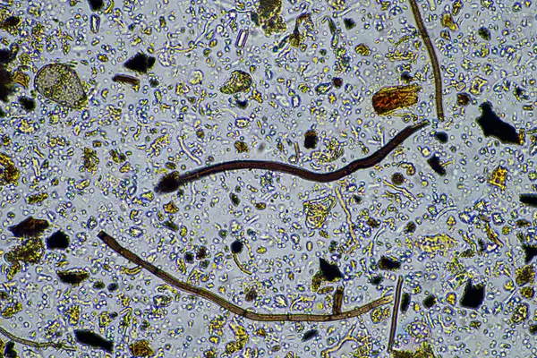 soil life under the microscope with soil fungi and fungal hyphae on a farm