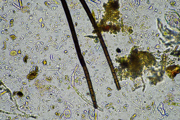 soil life under the microscope with soil fungi and fungal hyphae on a farm