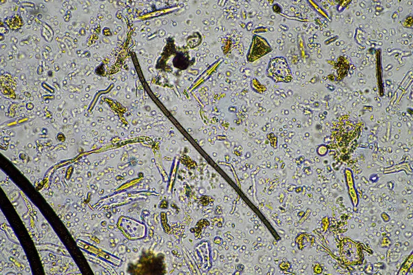 Hifas Fúngicas Fúngicas Bajo Microscopio Suelo Compost Una Prueba Biología — Foto de Stock