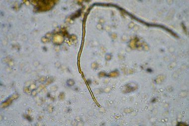 Kompost 'taki mikroorganizmalar ve biyoloji ve Avustralya' daki mikroskop altında toprak örneği