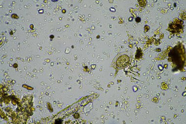 Kompost 'taki mikroorganizmalar ve biyoloji ve Avustralya' daki mikroskop altında toprak örneği