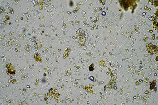Mikroorganismy Biologie Kompostu Vzorky Půdy Pod Mikroskopem Austrálii — Stock fotografie