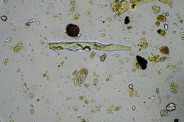 Микроорганизмы Биология Компосте Образце Почвы Микроскопом Австралии — стоковое фото