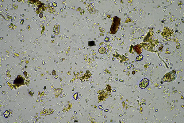Kompost Taki Mikroorganizmalar Biyoloji Avustralya Daki Mikroskop Altında Toprak Örneği — Stok fotoğraf